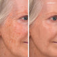 Enlighten Concealer™