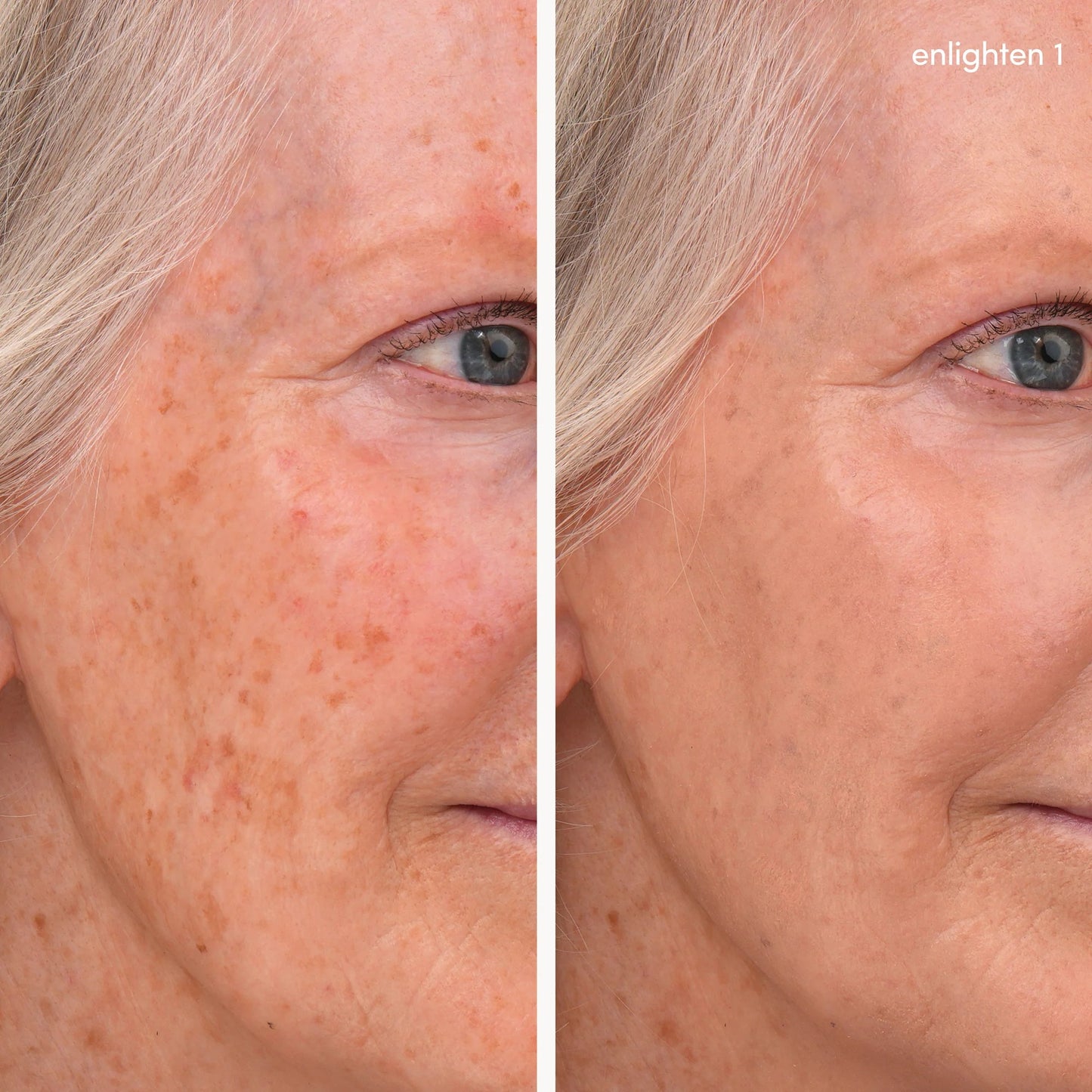 Enlighten Concealer™